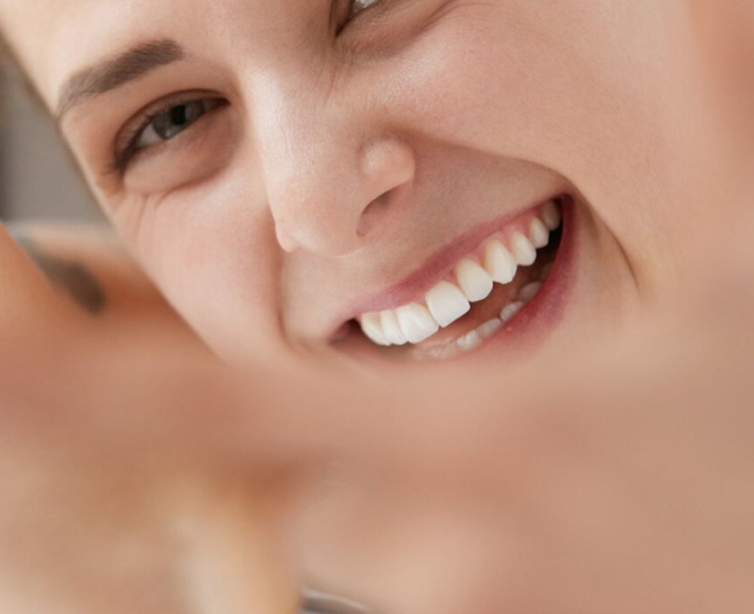 Estética Dental