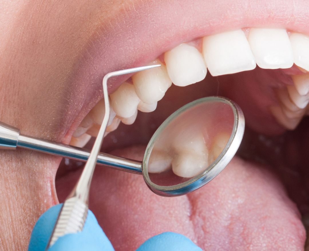 Periodoncia