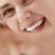 Estética Dental