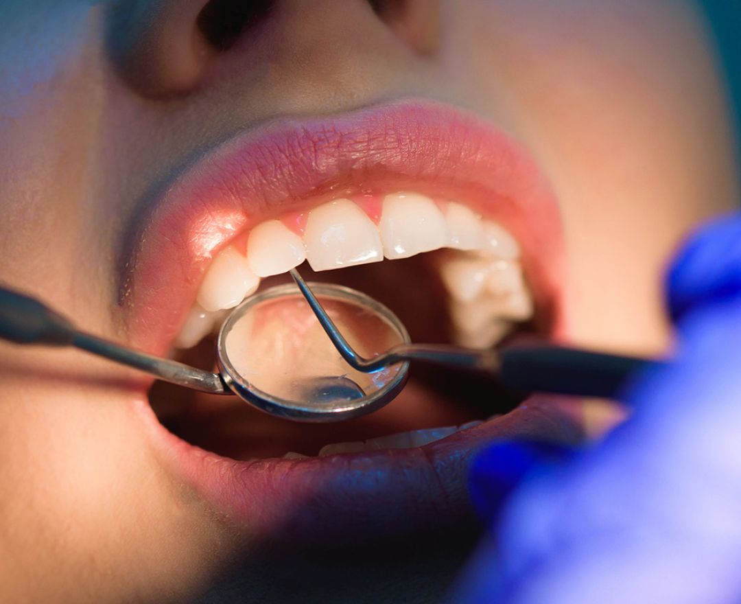 Odontología conservadora