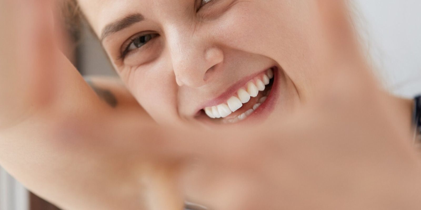 Estética Dental