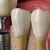 Implantología Dental