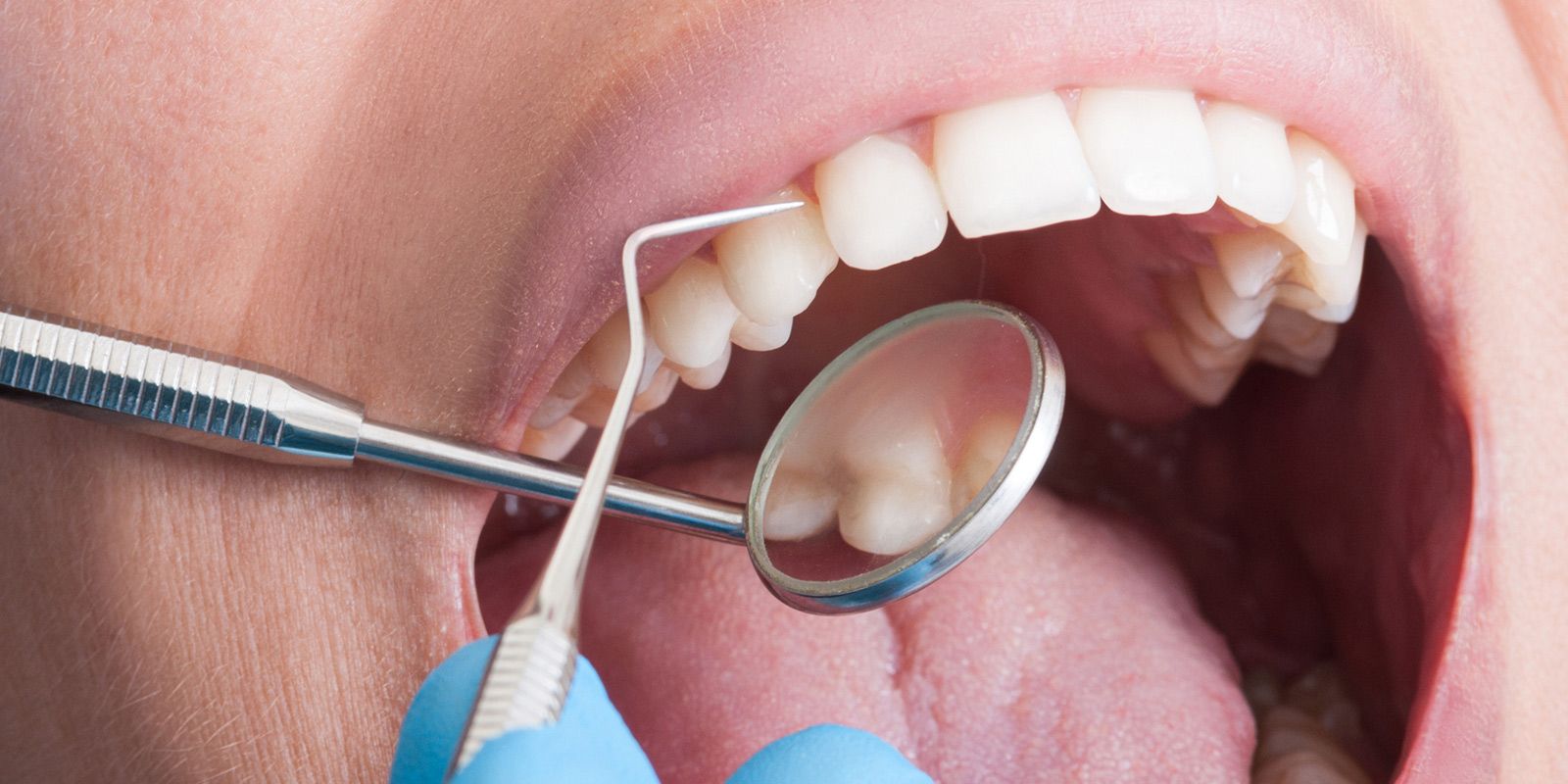 Periodoncia